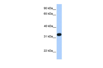 ACRV1 Rabbit Polyclonal Antibody