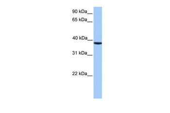 CSNK2A2 Rabbit Polyclonal Antibody
