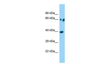 Ldha Rabbit Polyclonal Antibody