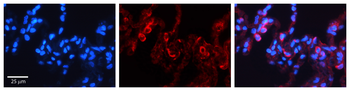 PDXK Rabbit Polyclonal Antibody