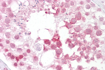 Ift88 Rabbit Polyclonal Antibody