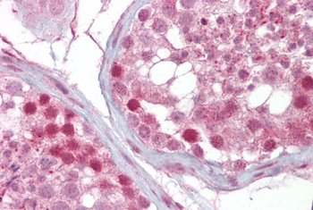 IFT88 Rabbit Polyclonal Antibody
