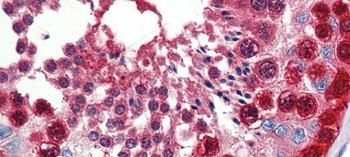 TKTL1 Rabbit Polyclonal Antibody