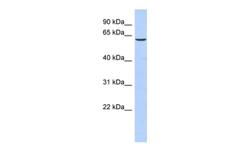TKTL1 Rabbit Polyclonal Antibody