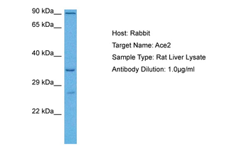 ACE2 Rabbit Polyclonal Antibody