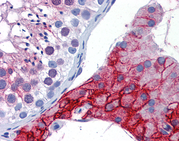 ACE2 Rabbit Polyclonal Antibody