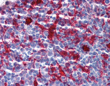 GSN Rabbit Polyclonal Antibody
