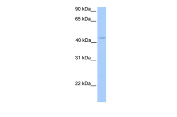C17orf97 Rabbit Polyclonal Antibody
