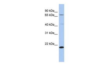 AMD1 Rabbit Polyclonal Antibody