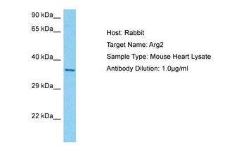 ARG2 Rabbit Polyclonal Antibody