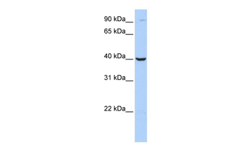 ARG2 Rabbit Polyclonal Antibody