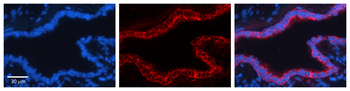 GCLC Rabbit Polyclonal Antibody