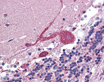 ARF6 Rabbit Polyclonal Antibody