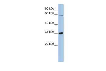 FRK Rabbit Polyclonal Antibody