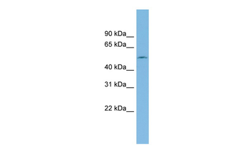 ETF1 Rabbit Polyclonal Antibody