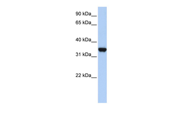LDHA Rabbit Polyclonal Antibody