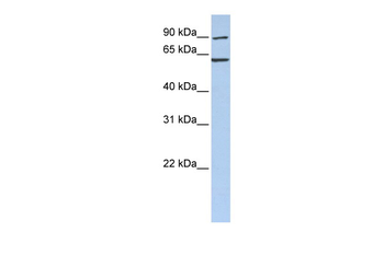 CCT5 Rabbit Polyclonal Antibody