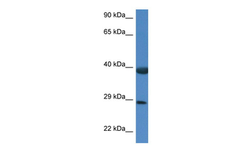 Hspbp1 Rabbit Polyclonal Antibody