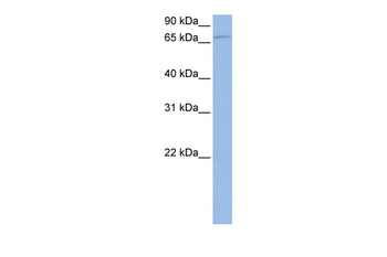 TBK1 Rabbit Polyclonal Antibody