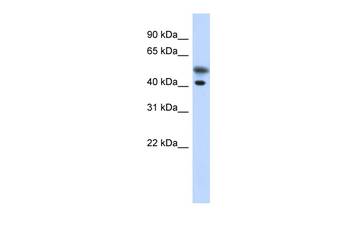 TMOD2 Rabbit Polyclonal Antibody