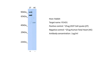 FCHO1 Rabbit Polyclonal Antibody