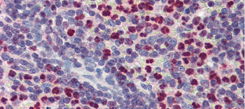 FCHO1 Rabbit Polyclonal Antibody
