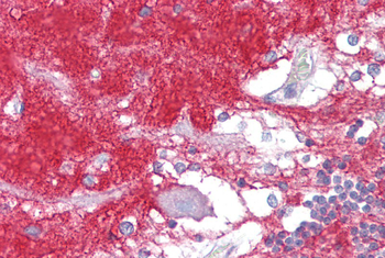 GNAO1 Rabbit Polyclonal Antibody