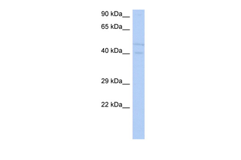SGK3 Rabbit Polyclonal Antibody