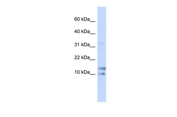 IL15 Rabbit Polyclonal Antibody