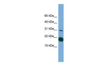 IL1F5 Rabbit Polyclonal Antibody