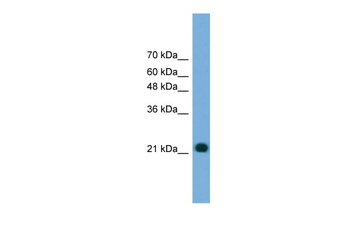 MYL4 Rabbit Polyclonal Antibody