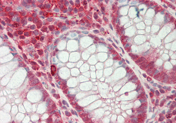 SFRS7 Rabbit Polyclonal Antibody