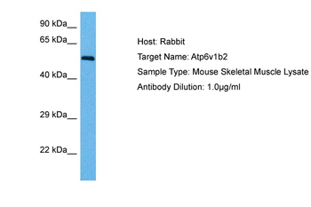 ATP6V1B1 Rabbit Polyclonal Antibody