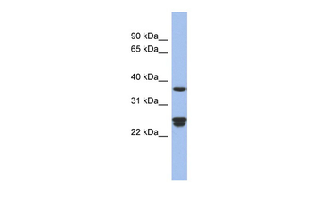 OAZ2 Rabbit Polyclonal Antibody