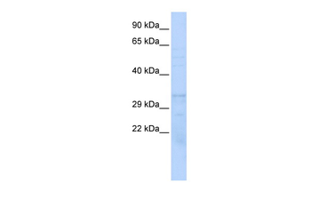 PSMB1 Rabbit Polyclonal Antibody
