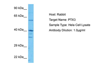 PTX3 Rabbit Polyclonal Antibody