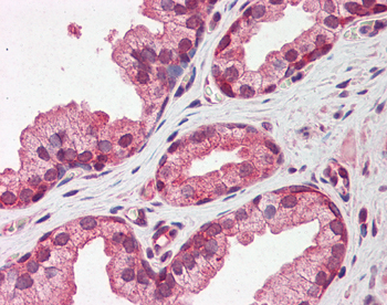 PTX3 Rabbit Polyclonal Antibody