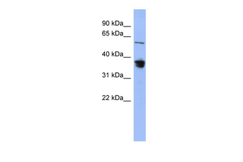 RAD23B Rabbit Polyclonal Antibody
