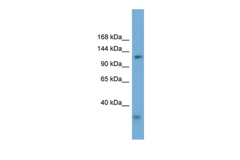 RFC1 Rabbit Polyclonal Antibody