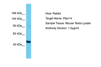 PTPN14 Rabbit Polyclonal Antibody