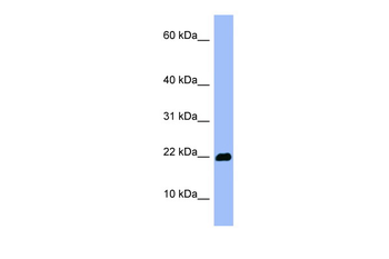 OMP Rabbit Polyclonal Antibody