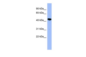 SERPINE2 Rabbit Polyclonal Antibody