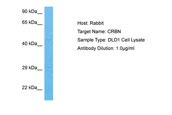 CRBN Rabbit Polyclonal Antibody