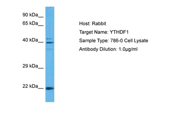 YTHDF1 Rabbit Polyclonal Antibody
