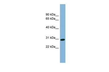 CENPQ Rabbit Polyclonal Antibody