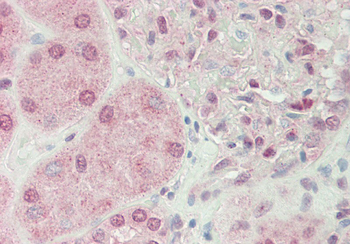 RIOK2 Rabbit Polyclonal Antibody