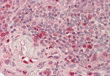RIOK2 Rabbit Polyclonal Antibody