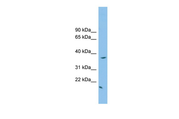 FKBPL Rabbit Polyclonal Antibody