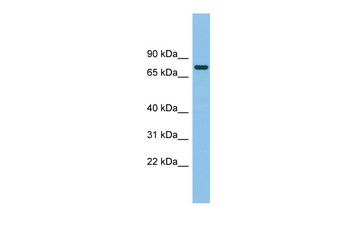 MTMR14 Rabbit Polyclonal Antibody