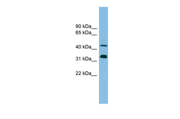 GORASP1 Rabbit Polyclonal Antibody